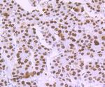 DDB2 Antibody in Immunohistochemistry (Paraffin) (IHC (P))