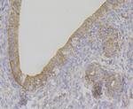 NDUFS4 Antibody in Immunohistochemistry (Paraffin) (IHC (P))