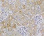 NDUFS4 Antibody in Immunohistochemistry (Paraffin) (IHC (P))