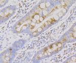 NDUFS4 Antibody in Immunohistochemistry (Paraffin) (IHC (P))