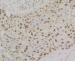 RPA2 Antibody in Immunohistochemistry (Paraffin) (IHC (P))