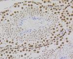 RPA2 Antibody in Immunohistochemistry (Paraffin) (IHC (P))