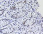 RNF40 Antibody in Immunohistochemistry (Paraffin) (IHC (P))