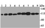 RNF40 Antibody in Western Blot (WB)