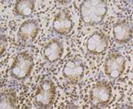 SRSF3 Antibody in Immunohistochemistry (Paraffin) (IHC (P))