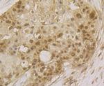 SRSF3 Antibody in Immunohistochemistry (Paraffin) (IHC (P))