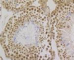 SRSF3 Antibody in Immunohistochemistry (Paraffin) (IHC (P))