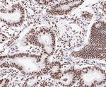 SAM68 Antibody in Immunohistochemistry (Paraffin) (IHC (P))