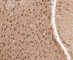 TPPP Antibody in Immunohistochemistry (Paraffin) (IHC (P))