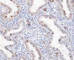 TPPP Antibody in Immunohistochemistry (Paraffin) (IHC (P))