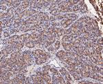 GSTK1 Antibody in Immunohistochemistry (Paraffin) (IHC (P))