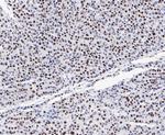 GTPBP4 Antibody in Immunohistochemistry (Paraffin) (IHC (P))