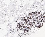 GTPBP4 Antibody in Immunohistochemistry (Paraffin) (IHC (P))