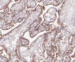 LYPLA1 Antibody in Immunohistochemistry (Paraffin) (IHC (P))