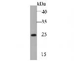 LYPLA1 Antibody in Western Blot (WB)