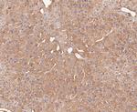 Calpain S1 Antibody in Immunohistochemistry (Paraffin) (IHC (P))