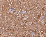 Calpain S1 Antibody in Immunohistochemistry (Paraffin) (IHC (P))