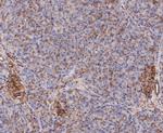 Calpain S1 Antibody in Immunohistochemistry (Paraffin) (IHC (P))