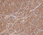 Calpain S1 Antibody in Immunohistochemistry (Paraffin) (IHC (P))