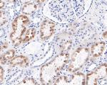 ENTPD5 Antibody in Immunohistochemistry (Paraffin) (IHC (P))