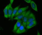 ACADM Antibody in Immunocytochemistry (ICC/IF)