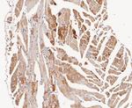 ACADM Antibody in Immunohistochemistry (Paraffin) (IHC (P))