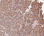 ACADM Antibody in Immunohistochemistry (Paraffin) (IHC (P))