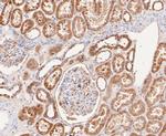 ACADM Antibody in Immunohistochemistry (Paraffin) (IHC (P))