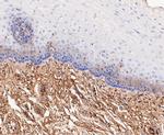 ACADM Antibody in Immunohistochemistry (Paraffin) (IHC (P))