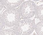 ACADM Antibody in Immunohistochemistry (Paraffin) (IHC (P))