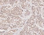 HSF2 Antibody in Immunohistochemistry (Paraffin) (IHC (P))