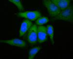 GCDFP-15 Antibody in Immunocytochemistry (ICC/IF)