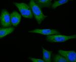 RSK1 Antibody in Immunocytochemistry (ICC/IF)