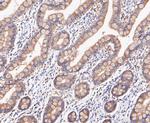 RSK1 Antibody in Immunohistochemistry (Paraffin) (IHC (P))