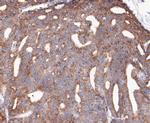 RSK1 Antibody in Immunohistochemistry (Paraffin) (IHC (P))