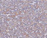 ENTPD5 Antibody in Immunohistochemistry (Paraffin) (IHC (P))