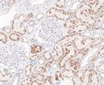 ENTPD5 Antibody in Immunohistochemistry (Paraffin) (IHC (P))