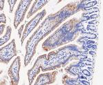 ENTPD5 Antibody in Immunohistochemistry (Paraffin) (IHC (P))