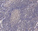 L-Plastin Antibody in Immunohistochemistry (Paraffin) (IHC (P))