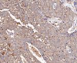 L-Plastin Antibody in Immunohistochemistry (Paraffin) (IHC (P))