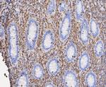 L-Plastin Antibody in Immunohistochemistry (Paraffin) (IHC (P))