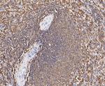 L-Plastin Antibody in Immunohistochemistry (Paraffin) (IHC (P))