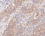 BCL2L12 Antibody in Immunohistochemistry (Paraffin) (IHC (P))