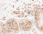 LTA4H Antibody in Immunohistochemistry (Paraffin) (IHC (P))