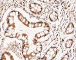 LTA4H Antibody in Immunohistochemistry (Paraffin) (IHC (P))