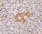 LTA4H Antibody in Immunohistochemistry (Paraffin) (IHC (P))