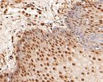 LTA4H Antibody in Immunohistochemistry (Paraffin) (IHC (P))