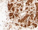 PSMA3 Antibody in Immunohistochemistry (Paraffin) (IHC (P))