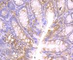 CTHRC1 Antibody in Immunohistochemistry (Paraffin) (IHC (P))