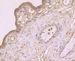 CTHRC1 Antibody in Immunohistochemistry (Paraffin) (IHC (P))